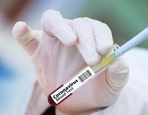 Brit kutatók vizsgálják, hogy lehet-e kombinálni a különböző koronavírus-oltások két adagját